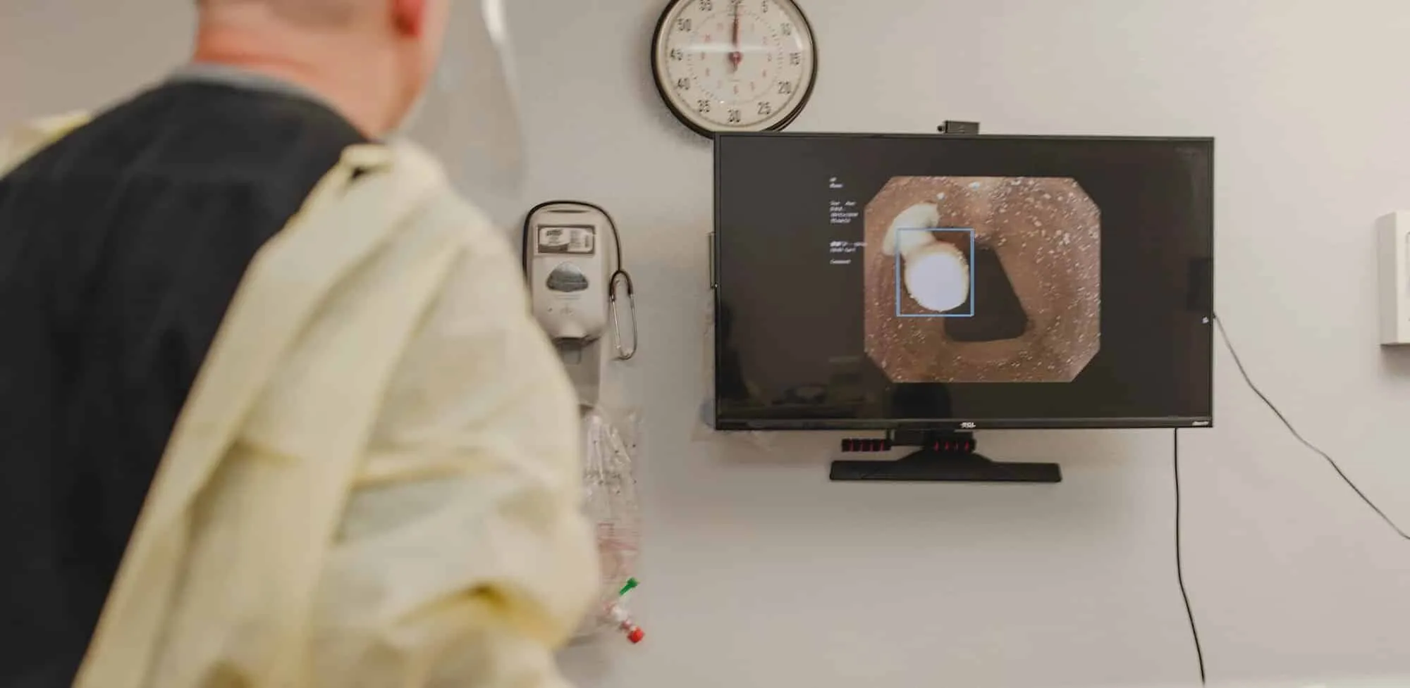 Virgo's endoscopic video system enlists Coral's AI platform to fight colon cancer