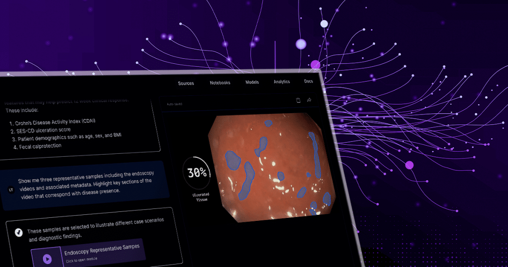 EndoML platform identifying ulcers in endoscopy
